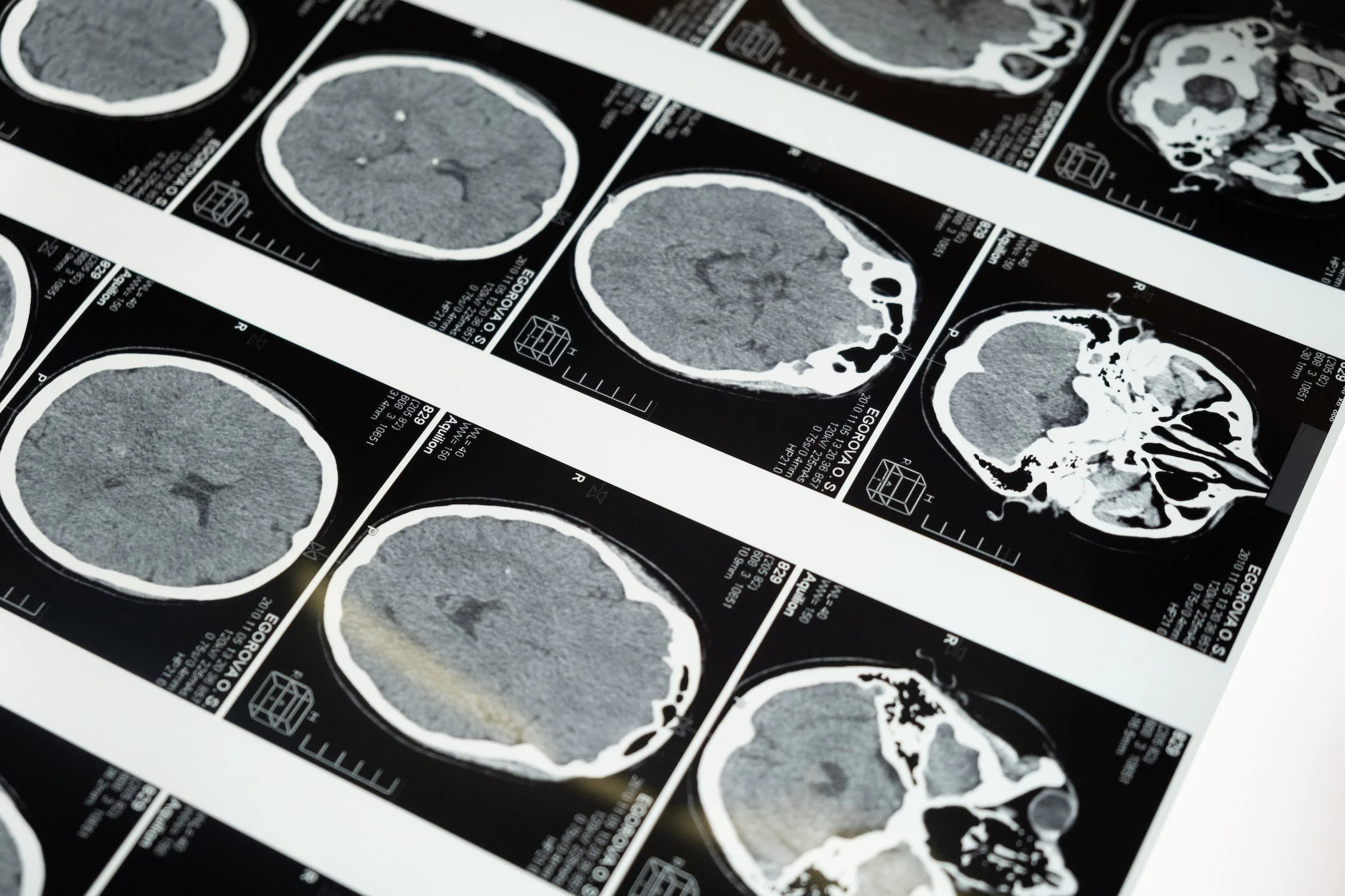 Les aliments ultra-transformés abîment le cerveau